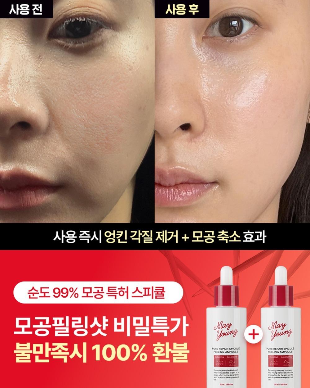 [🤫광고전용 비밀링크] 모공 리페어 스피큘 필링 앰플