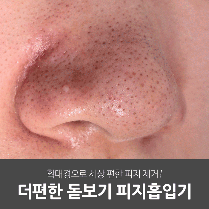 일상공감 더편한 돋보기 피지흡입기