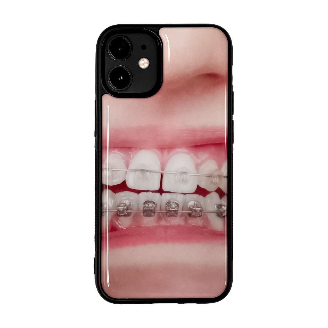 Teeth Epoxy Case