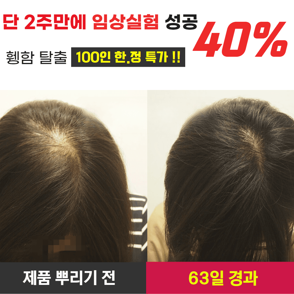 (3종 임상 완료) 실비에라 EGCG 트리니티™