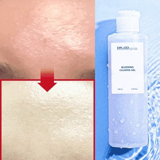 [최저가/피부과 입점] 블루밍 카밍 젤 쿨링 수딩젤 홍조 진정
