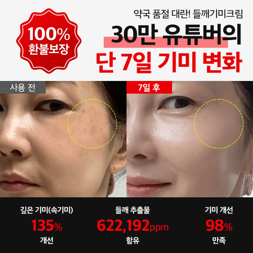 [🔒광고전용 비밀링크] 약국기미크림 선착순 300명 특가