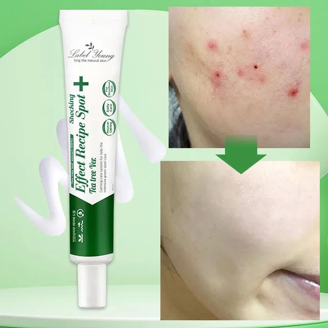 고농축티트리💥여드름킬러😍예민 트러블끝! 효과빠른 진정+집중관리 쇼킹스팟티트리버전