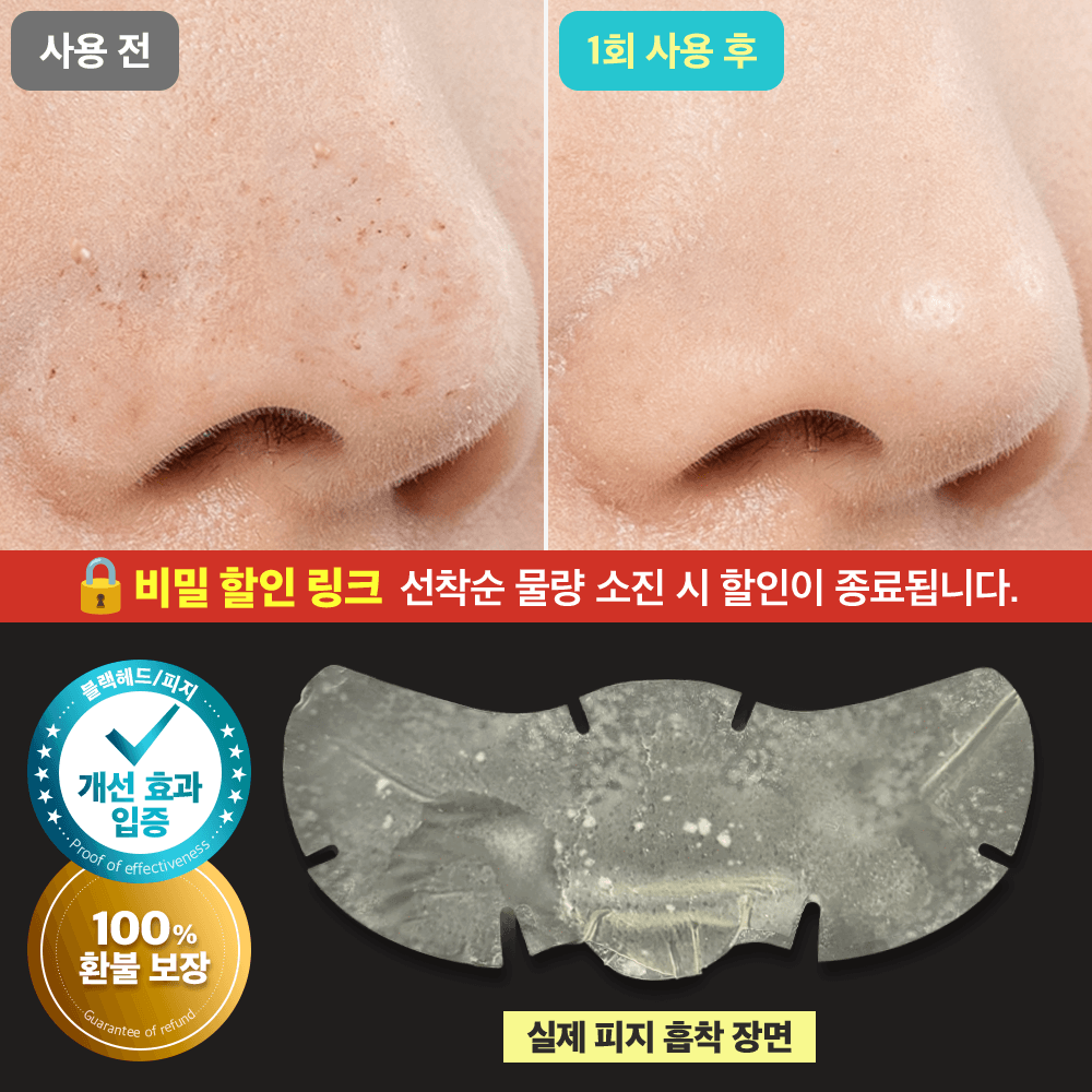 ★광고전용 비밀링크★ 피지 녹이는 모공팩 선착순 특가