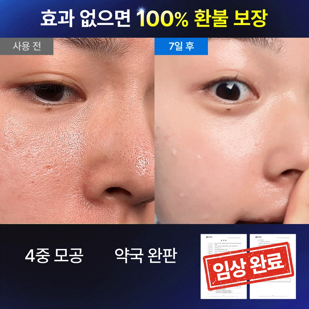 🔥딱 3시간만 1+1🔥 약국 지우개패드 선착순 특가