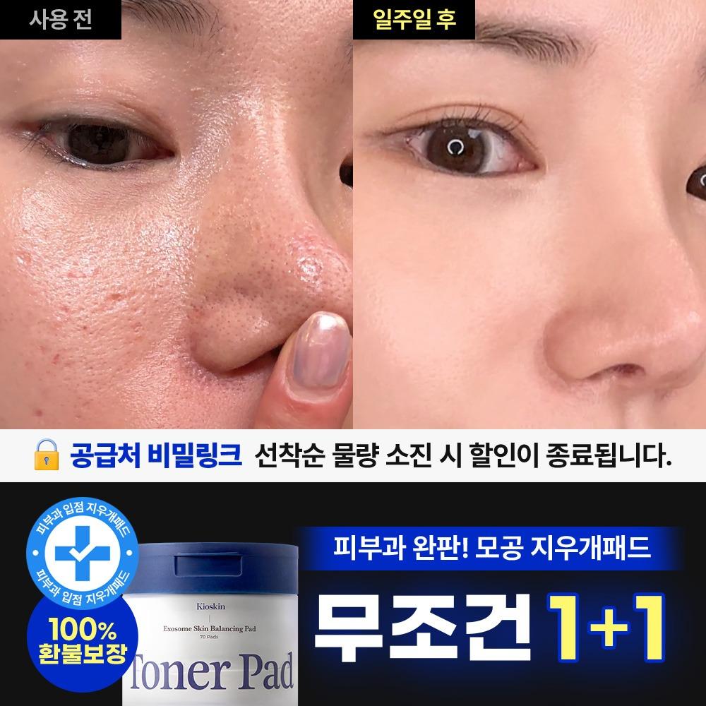 ♥단 하루만!♥ 1+1 선착순 특별 할인 한정 수량 7일 지우개패드