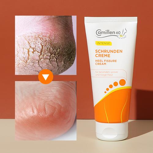 독일 슈르덴 풋크림 카모마일 고농축 팔꿈치 발뒤꿈치 갈라짐 발 보습제 각질제거 팩