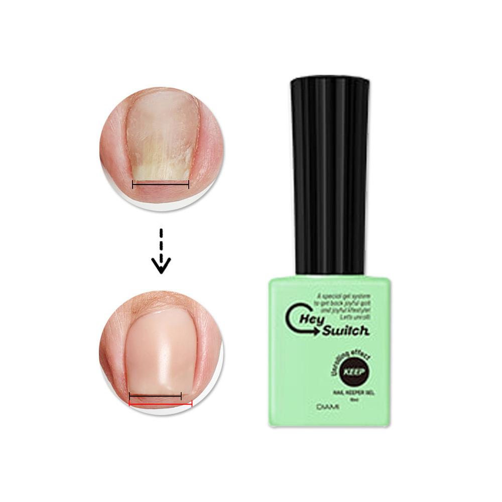 다이아미 헤이스위치젤 키퍼젤 파고드는발톱 말린손톱