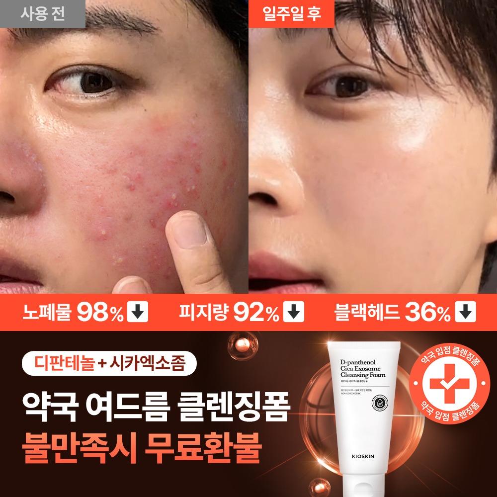 🎁광고전용 비밀링크🎁 약국 여드름 클렌징폼 선착순 특가