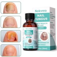 [당일배송] Nekvnro 발톱무좀 리페어 세럼 문제성 손발톱 손톱 영양제 무좀 강화제 약 발톱 세로줄