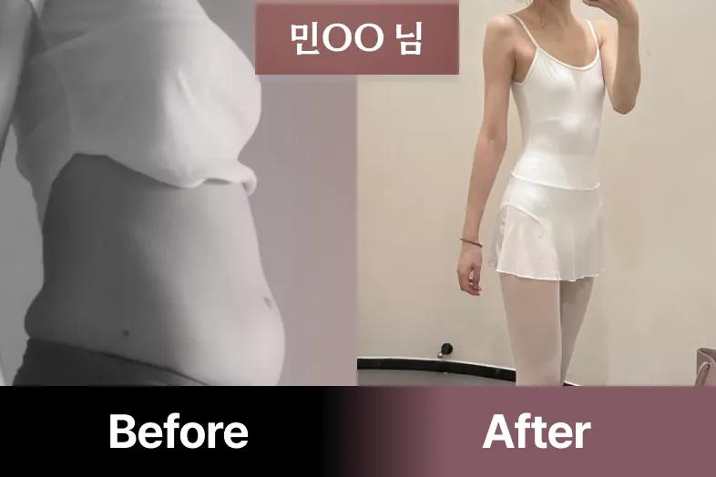 여신핏과 곧은 자세를 한방에! 나를 위한 선물 <예핏 홈발레> | 배움을 재밌게, 탈잉!