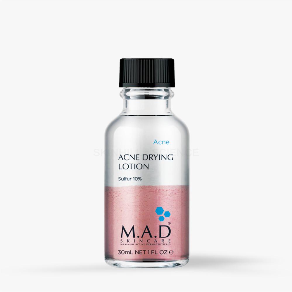 매드 스킨케어 아크네 드라잉 로션 (설퍼 10%) 30g