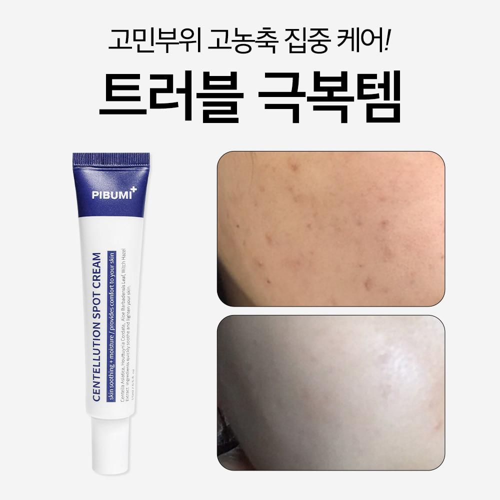 ★브랜드데이★센텔루션 스팟 크림 15ml