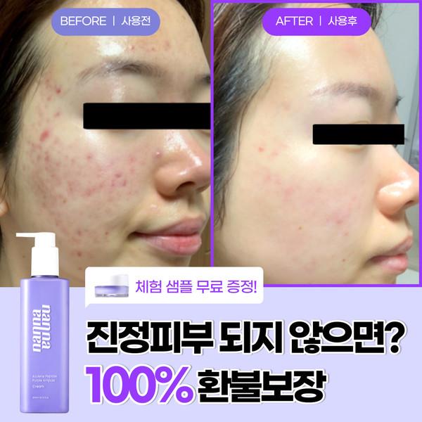 ★100% 환불보장 & 출시 기념★ 진정 줄렌 보라 앰플 크림 300ml 대용량