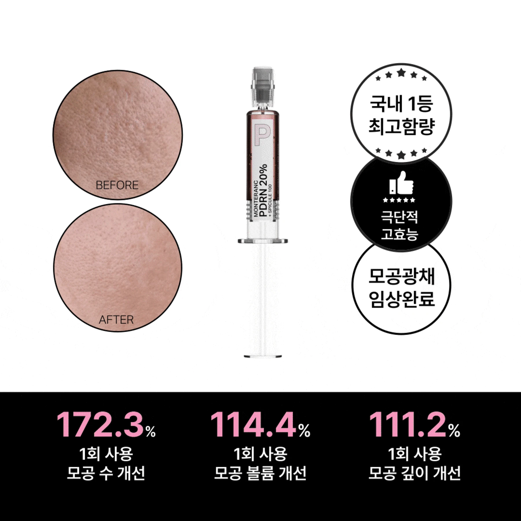 몽태랑 슈퍼파워앰플 4종 특별기획 SET 국내최초 최고함량 고효능 임상완료  9ML