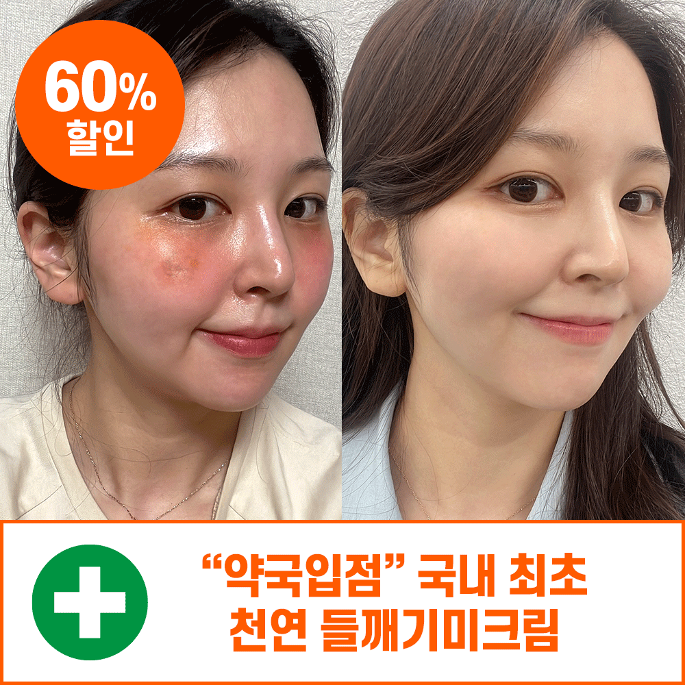 [강남약국크림] 들깨기미크림 (단 3일만 60%)