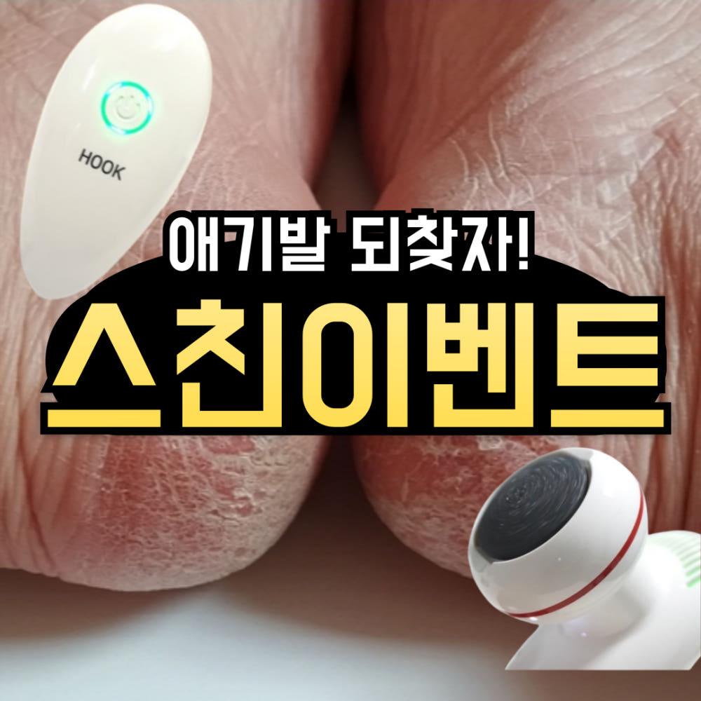 [스친전용] 애기 발꿈치 되찾기 프로젝트