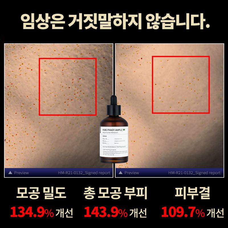 [🔒비밀링크] 라돌프 퓨어파지앰플RX