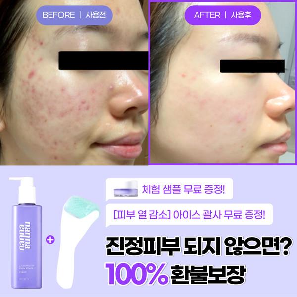 ★100% 환불보장★ 난나 진정 줄렌 보라 크림 아줄렌 300ml 대용량