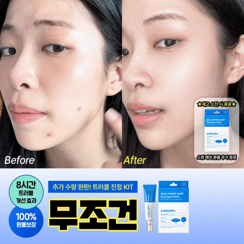 [🔒비밀링크] 8시간 트러블 진정 KIT