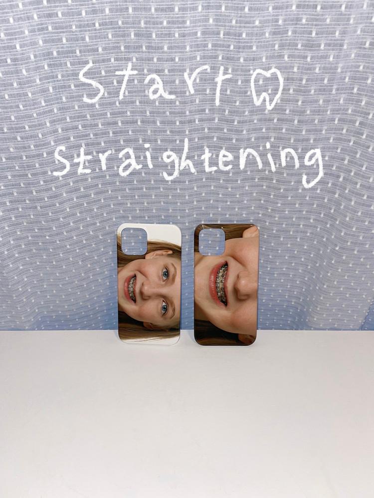 [mei] teeth 하드 tok 세트 1(얼굴) 투명그립 아이폰15